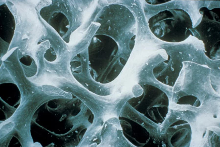 Régénération tissulaire et osseuse - Dr Bouganim Paris 6